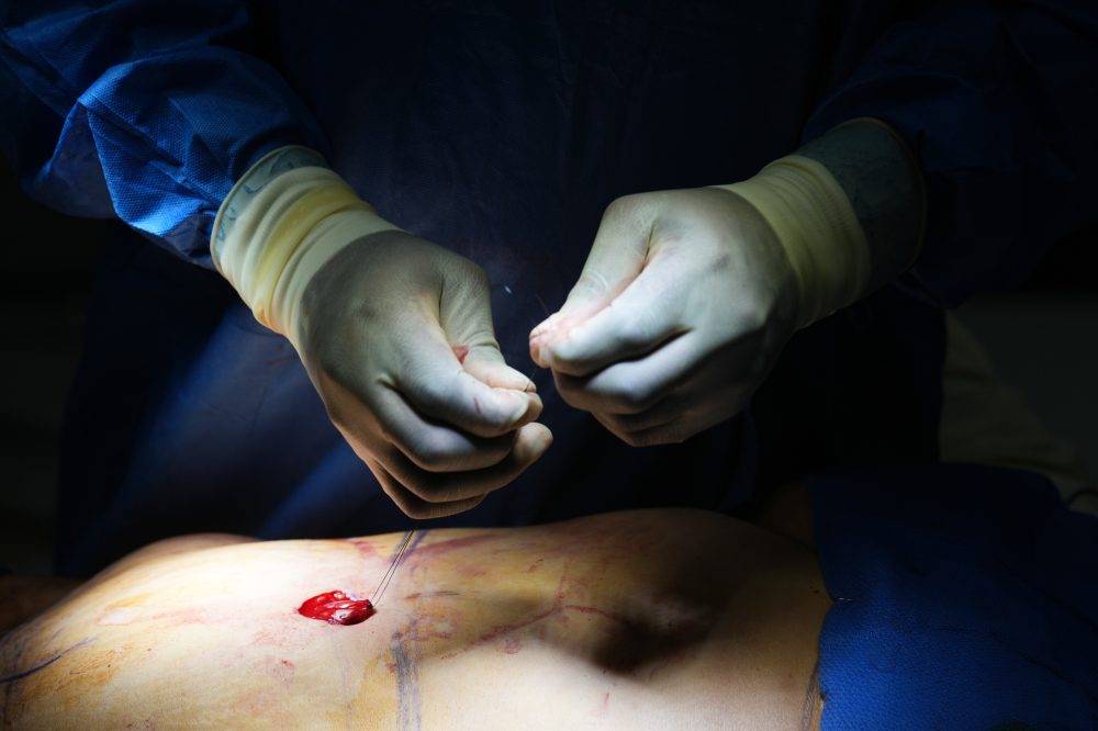 Cosmetic Procedures Surge as Experts Call for More Ethical Discussions
