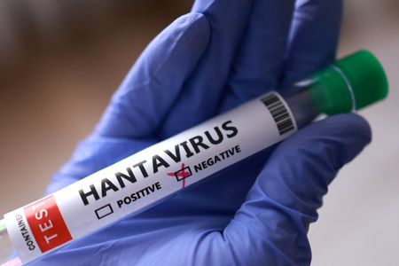 Dutch Flight Attendant Clears Hantavirus Test After Exposure Scare