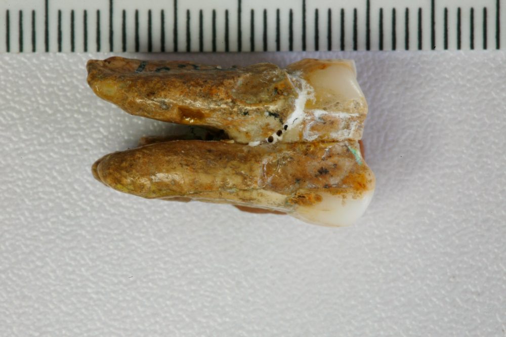Fossil Teeth Reveal Mating Between Ancient Human Species