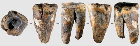 Ancient Neanderthal Tooth Shows Evidence of 59,000-Year-Old Dental Surgery
