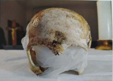 Czech Authorities Arrest Man in Medieval Saint’s Skull Theft