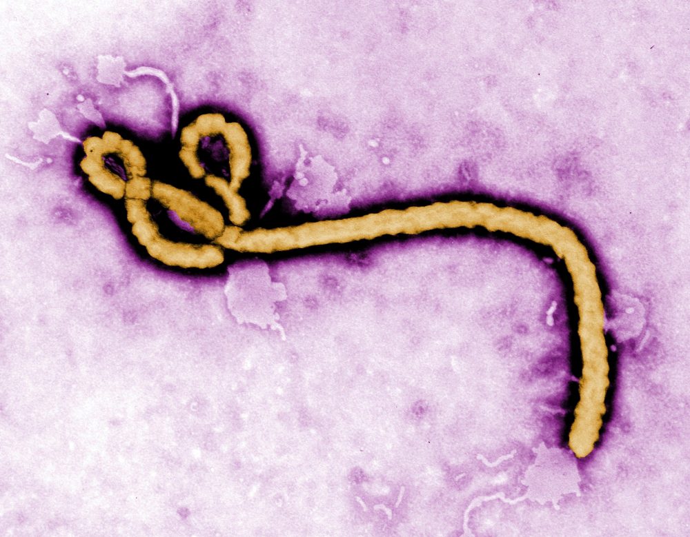 Congo Reports New Ebola Outbreak as Health Officials Track Disease’s 50-Year History