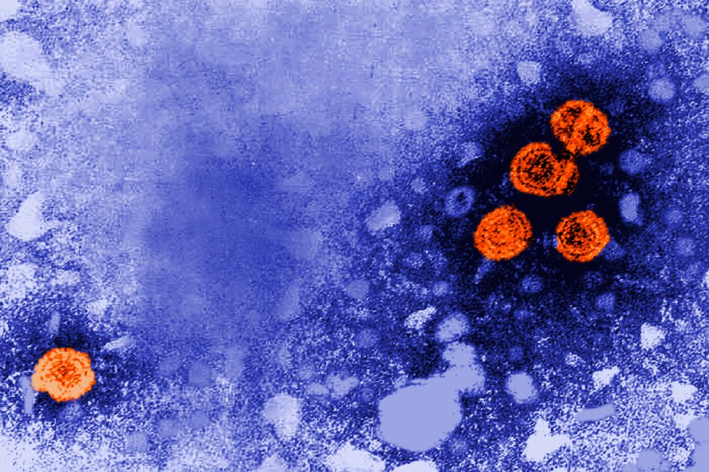 New Hepatitis B Treatment Shows Promise as ‘Functional Cure’ for Some Patients