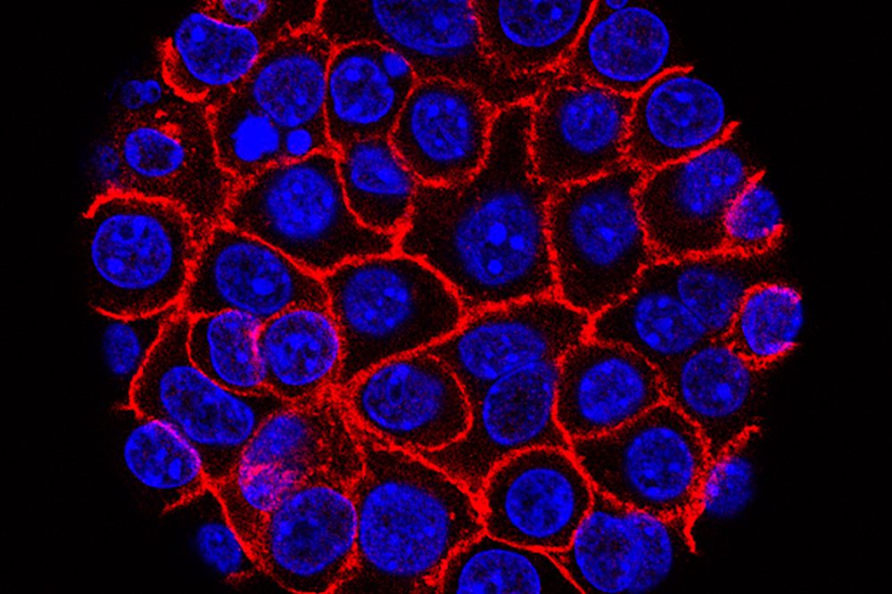 New Pancreatic Cancer Pill Shows Promise in Clinical Trial
