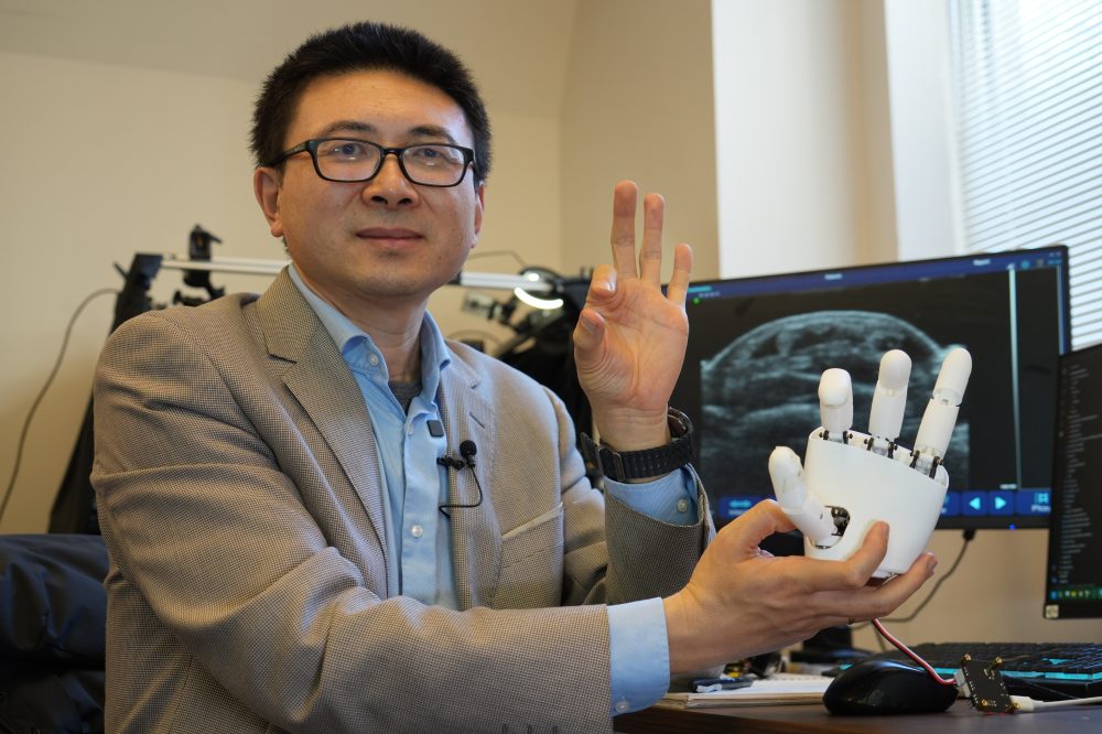 Scientists Create Wristband That Teaches Robots Hand Movements Using AI