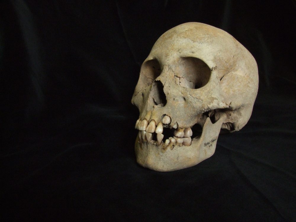 Ancient Siberian Teeth Push Plague’s Origins Back 5,500 Years