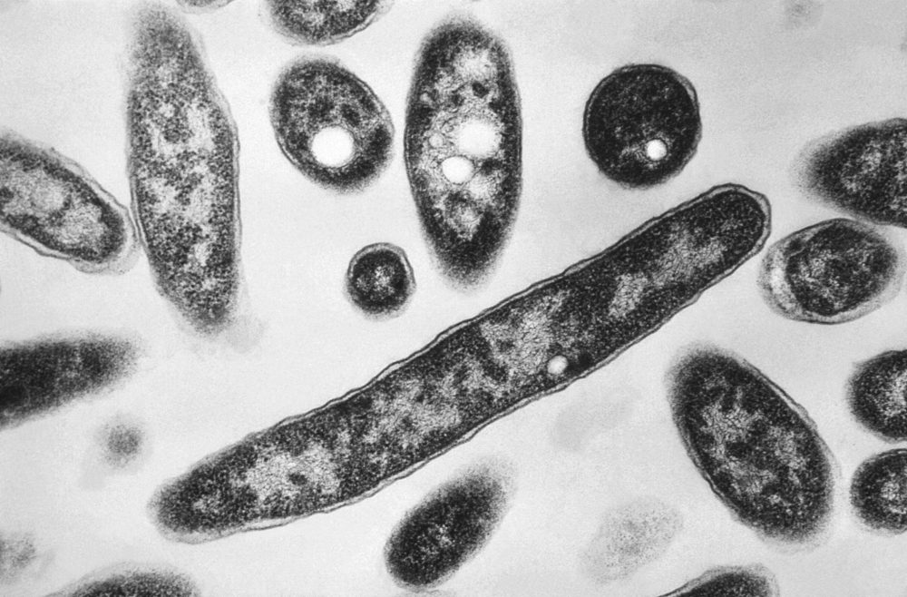 Legionnaires’ Disease Outbreak in NYC: What You Need to Know