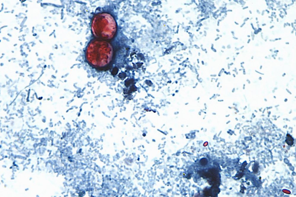 Food Poisoning at Restaurant Chains: A History of Outbreaks That Shook the Industry