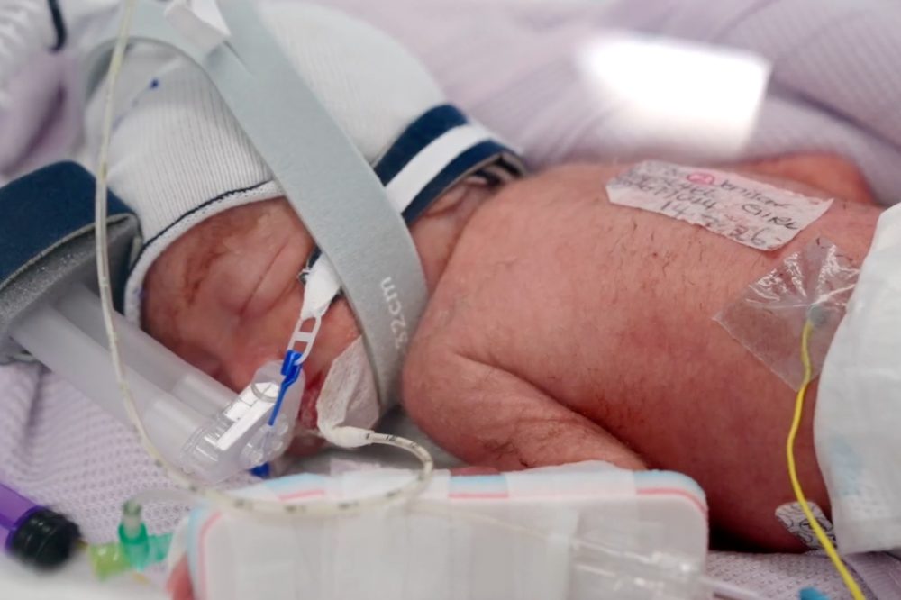 Australian Woman Delivers Identical Quadruplet Girls in 1-in-15-Million Birth